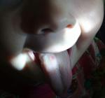 Красное пятно на языке у ребенка фото 1