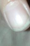 Неровность на ногте выемка фото 1