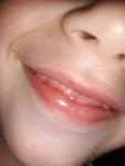 Красное пятно на губе у ребенка фото 1