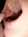Боль в щеке после лечения зуба семёрки фото 2