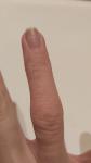 Сухая кожа на пальце руки фото 2