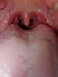 При боли в горле отдает в ухо и зубы фото 1
