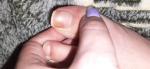 Изменение цвета на ногте и сухость фото 1