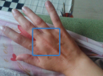 Боль в суставе правой руки среднего пальца фото 2