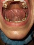 Болит язык, лимфоузлы фото 4