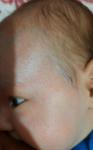 Аллергия у новорожденного на гв, диета не приносит результат фото 5