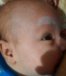 Аллергия у новорожденного на гв, диета не приносит результат фото 2