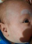 Аллергия у новорожденного на гв, диета не приносит результат фото 3