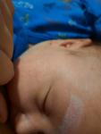 Аллергия у новорожденного на гв, диета не приносит результат фото 1