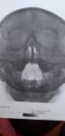 Ренген снимок пазух носа, фото 1