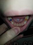 Детские зубы фото 3