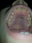 Детские зубы фото 2