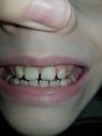 Детские зубы фото 1