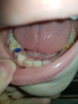 Детские зубы фото 4