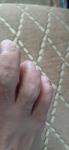 Полосы на ногте безымянного па льца ноги фото 1