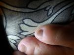 Темные полосы на ногте ноги фото 5
