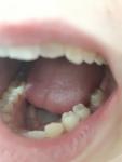 Боль в здоровом зубе? фото 1