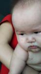 Красное высыпание на теле у ребенка 6 месяцев фото 4