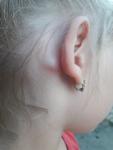 Кость у ребенка за ухом фото 1