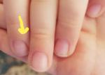 Белая полоса на ногте руки у ребенка фото 2