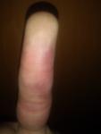Боль и почерненее пальца руки фото 4