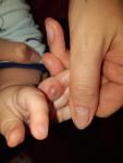 Шишка на пальце у ребёнка фото 1
