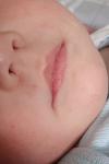 Пятно под носом у ребенка 1 год и 2 месяца фото 2