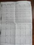 Расшифровка кардиограммы проблемы с давлением фото 1