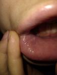 Жжение, боль припухлостей в слизистой нижней губы фото 2