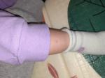 Сыпь на ножках у ребенка фото 3