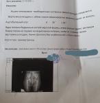 Дисплазия тазобедренного сустава у ребёнка 6мес фото 1