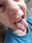 Пятно на языке у ребенка фото 1