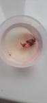 Вышел сгусток-капсула из тканей и крови при месячних фото 2
