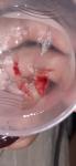 Вышел сгусток-капсула из тканей и крови при месячних фото 1