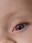 Воспаление глаза ребёнка 9 мес фото 1