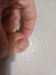 Коричневое пятно на ногте, опасно ли? фото 3