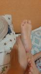 Пятна на ступнях ног у ребёнка фото 1