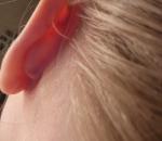 Небольшая красная шишка за ухом фото 2