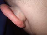 Червоні цятки що переходять у ранки на вухові дитини фото 5