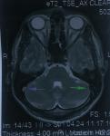 МРТ головного мозку фото 4