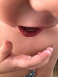 Воспалённое Образование на губе у ребёнка, когда трогаешь ребёнку больно фото 3