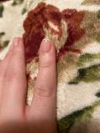 Красные продольные полосы на ногтях после покрытия гель-лаком фото 5