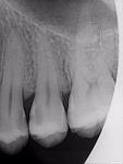 Стоит ли лечить зубы, показанные на снимке? фото 1