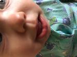 Язвочка на губе ребенка фото 1