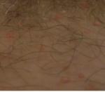 Сыпь в паховой области, красные пятна (нет зуда) фото 1