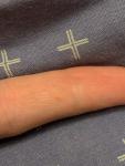 Маленькая красная точка на пальце руки со тонким стержнем фото 2
