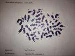 Помощь в расшифровке заключения цитогенетического исследования ворсин хориона фото 1