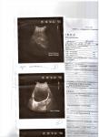 Результаты УЗИ брюшной полости, почек и мочевого пузыря фото 3