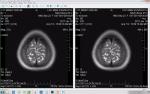 Помогите описать МРТ головного мозга фото 2