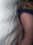 Красные пятна у ребёнка аллергия? фото 3